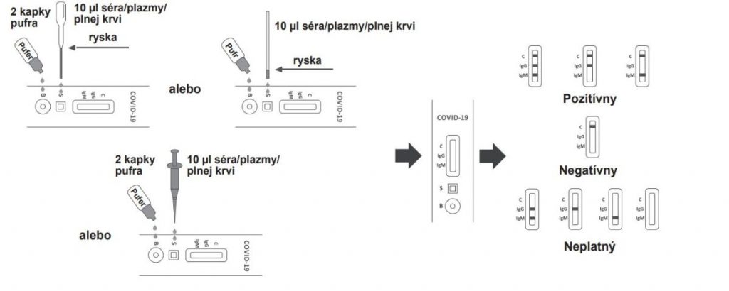 COVID- 19 TEST