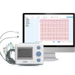 The 12 lead holter recorder with AI Analysis